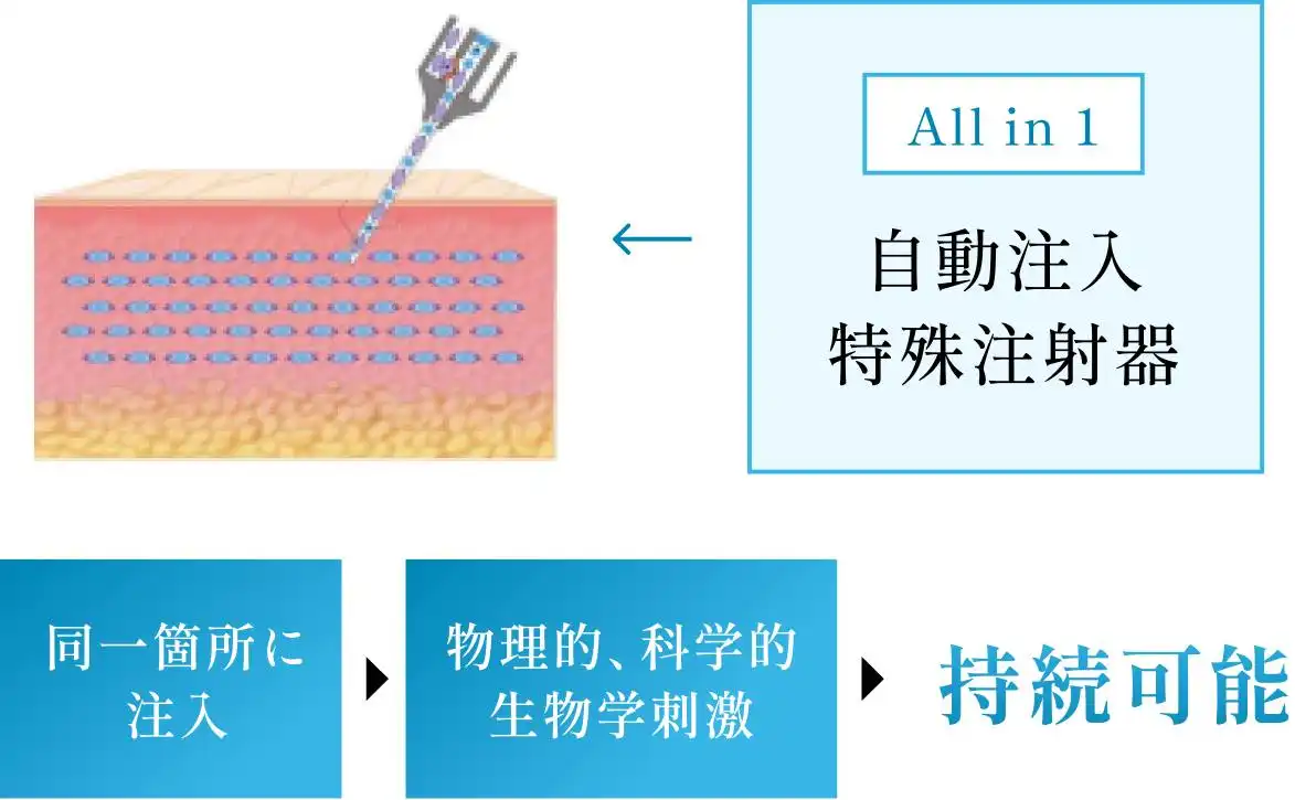 ジュブゼン JUVGEN 自己真皮再生 コラーゲン増生 症例画像