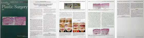 ジュブゼン JUVGEN 医療論文掲載 Annals of Plastic Surgery